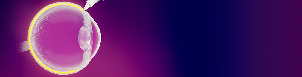 xipere logo